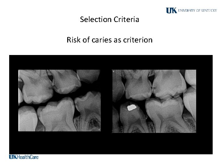 Selection Criteria Risk of caries as criterion 