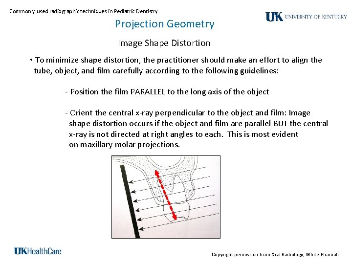 Commonly used radiographic techniques in Pediatric Dentistry Projection Geometry Image Shape Distortion • To