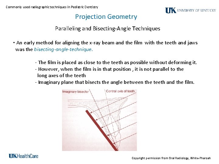 Commonly used radiographic techniques in Pediatric Dentistry Projection Geometry Paralleling and Bisecting-Angle Techniques •