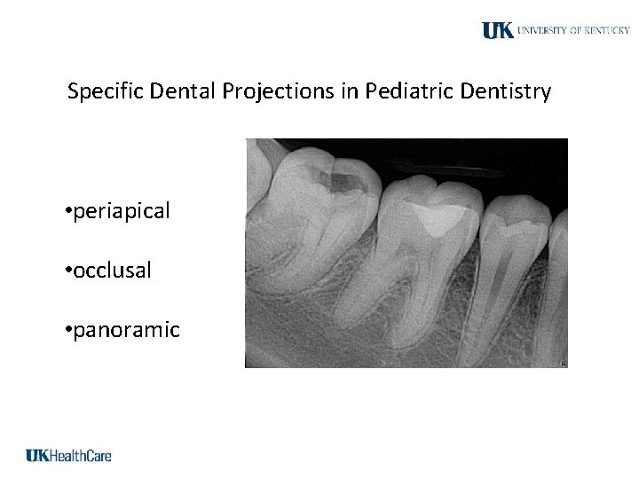 Specific Dental Projections in Pediatric Dentistry • periapical • occlusal • panoramic 