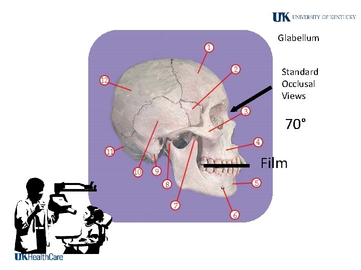 Glabellum Standard Occlusal Views 70° Film 