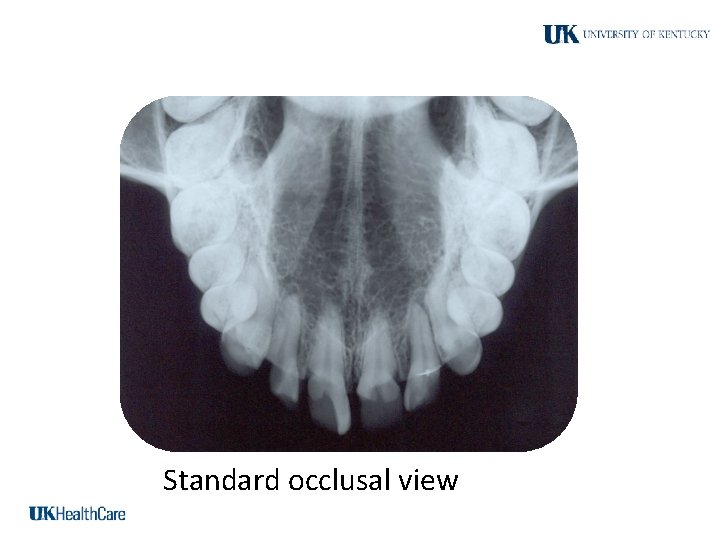 Standard occlusal view 