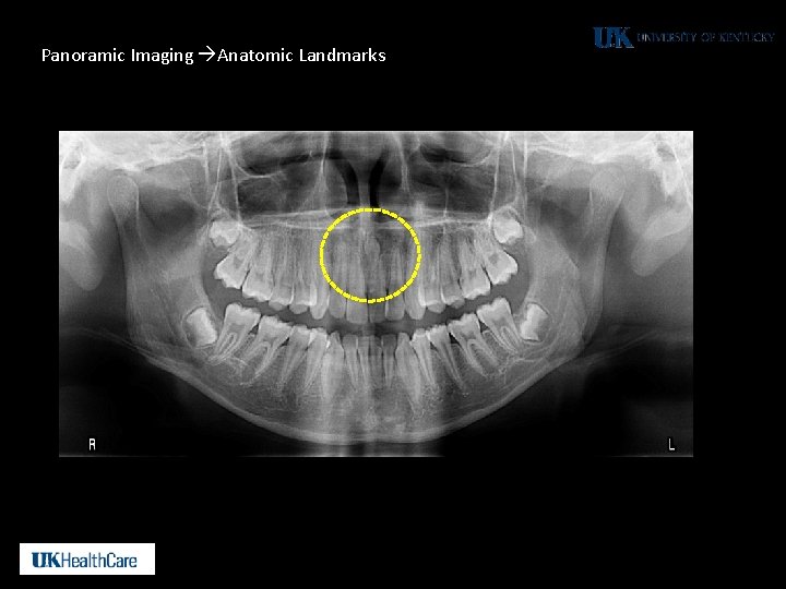 Panoramic Imaging Anatomic Landmarks 