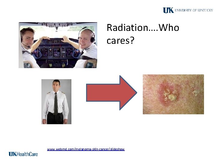 Radiation…. Who cares? www. webmd. com/melanoma-skin-cancer/slideshow 