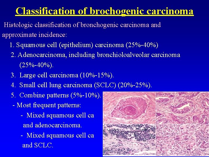 Classification of brochogenic carcinoma Histologic classification of bronchogenic carcinoma and approximate incidence: 1. Squamous