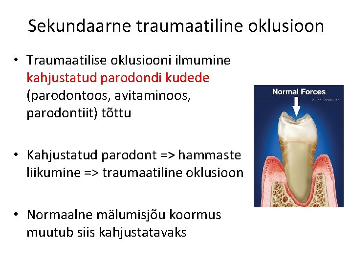 Sekundaarne traumaatiline oklusioon • Traumaatilise oklusiooni ilmumine kahjustatud parodondi kudede (parodontoos, avitaminoos, parodontiit) tõttu