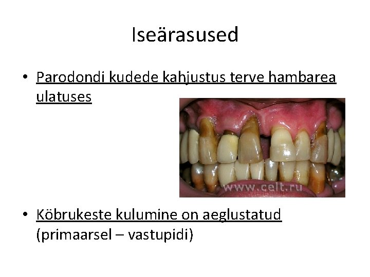 Iseärasused • Parodondi kudede kahjustus terve hambarea ulatuses • Köbrukeste kulumine on aeglustatud (primaarsel