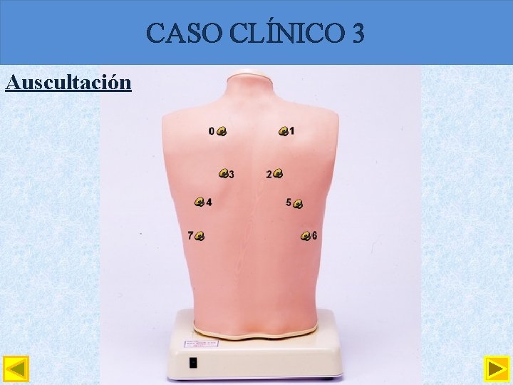 CASO CLÍNICO 3 Auscultación 