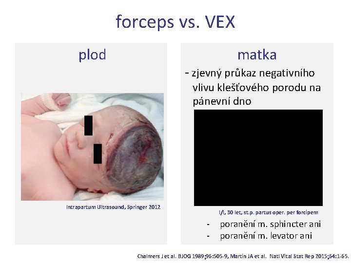 forceps vs. VEX plod matka - zjevný průkaz negativního vlivu klešťového porodu na pánevní