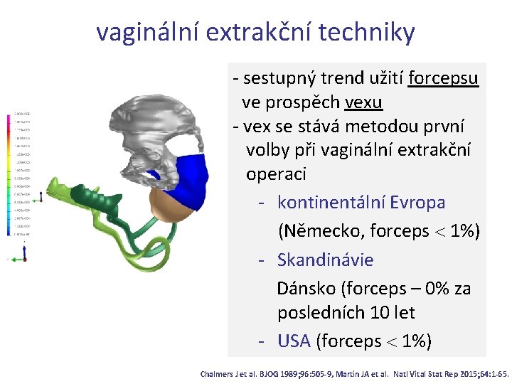vaginální extrakční techniky - sestupný trend užití forcepsu ve prospěch vexu - vex se