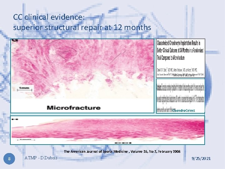 CC clinical evidence: superior structural repair at 12 months Microfracture Chondro. Celect The American