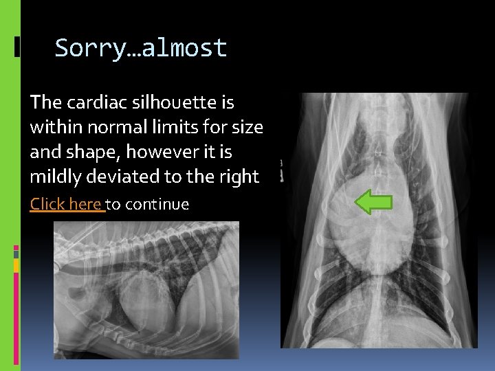 Sorry…almost The cardiac silhouette is within normal limits for size and shape, however it