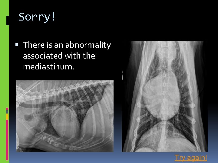 Sorry! There is an abnormality associated with the mediastinum. Try again! 