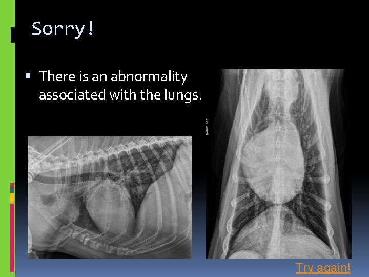 Sorry! There is an abnormality associated with the lungs. Try again! 