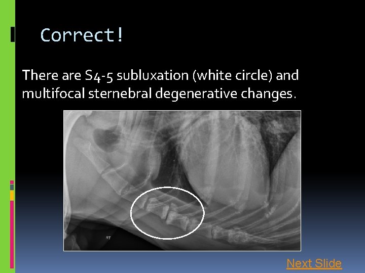 Correct! There are S 4 -5 subluxation (white circle) and multifocal sternebral degenerative changes.
