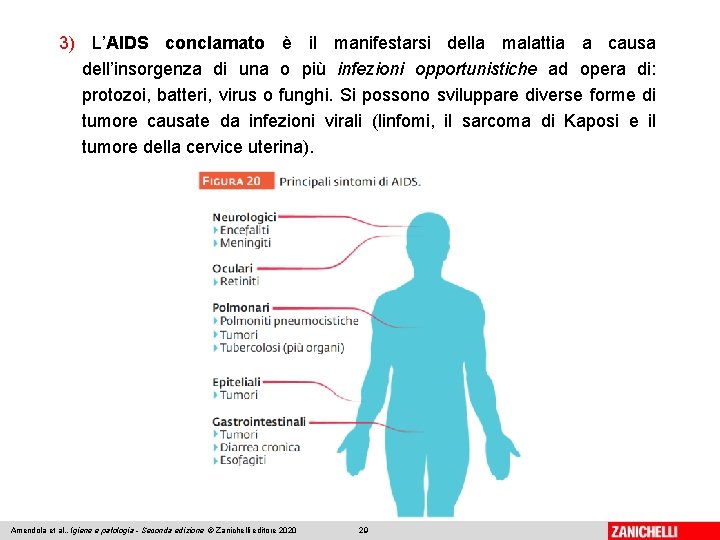 3) L’AIDS conclamato è il manifestarsi della malattia a causa dell’insorgenza di una o