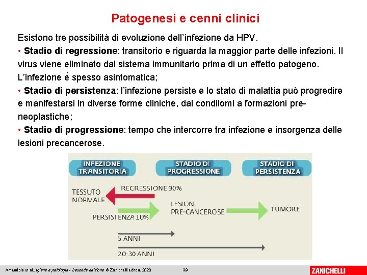 Patogenesi e cenni clinici Esistono tre possibilità di evoluzione dell’infezione da HPV. • Stadio