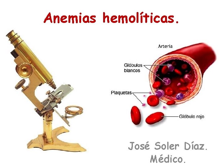 Anemias hemolíticas. José Soler Díaz. Médico. 