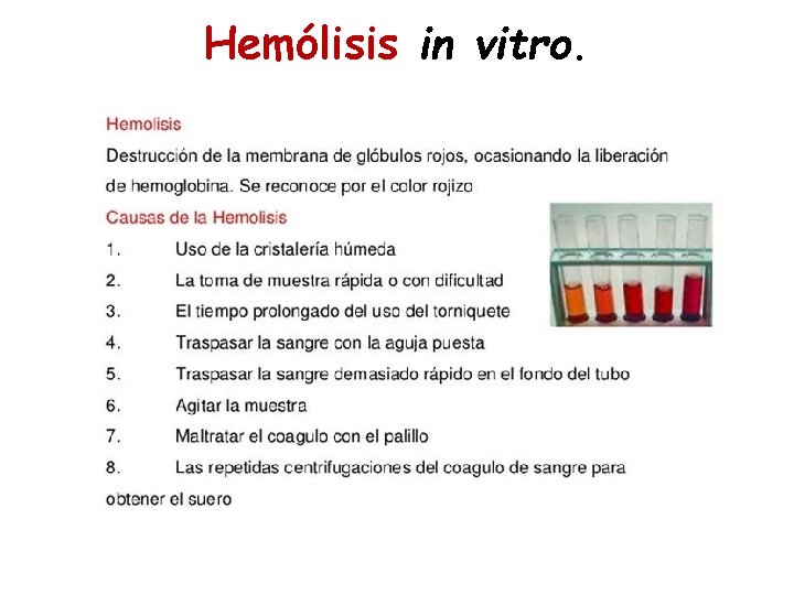 Hemólisis in vitro. 