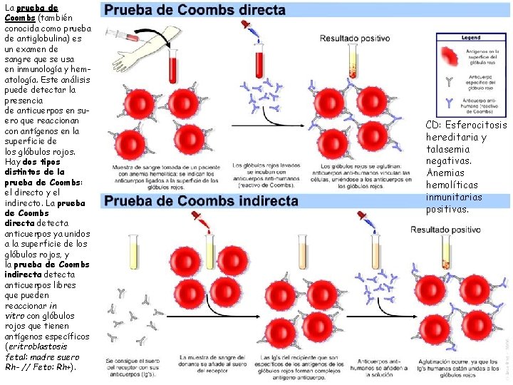 La prueba de Coombs (también conocida como prueba de antiglobulina) es un examen de
