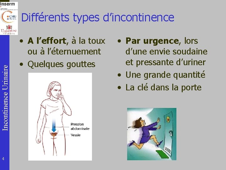 Incontinence Urinaire Différents types d’incontinence 4 • A l’effort, à la toux ou à