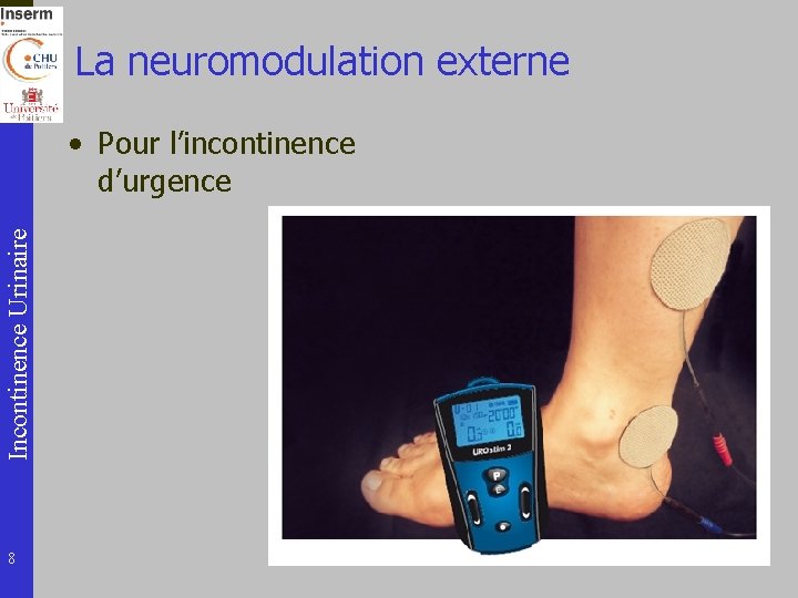 La neuromodulation externe Incontinence Urinaire • Pour l’incontinence d’urgence 8 