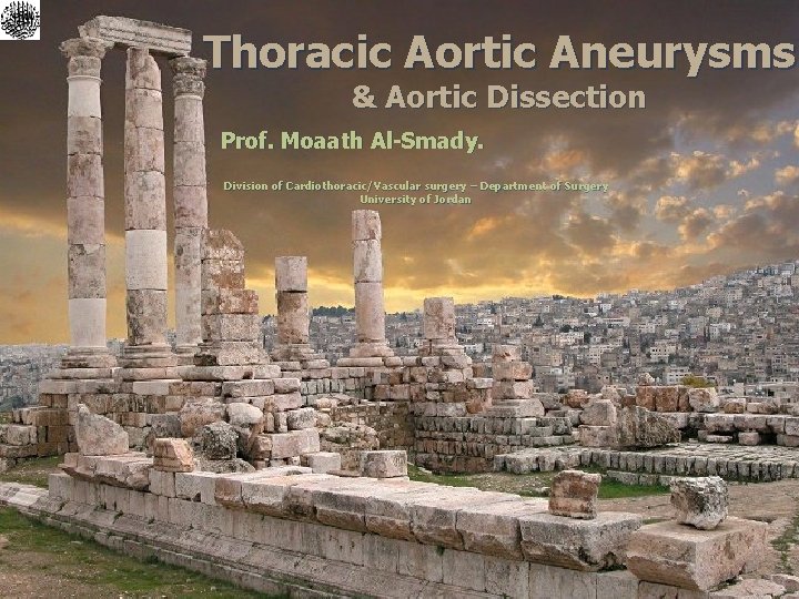 Thoracic Aortic Aneurysms & Aortic Dissection Prof. Moaath Al-Smady. Division of Cardiothoracic/Vascular surgery –