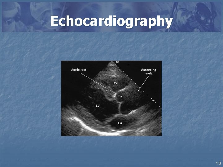 Echocardiography 13 