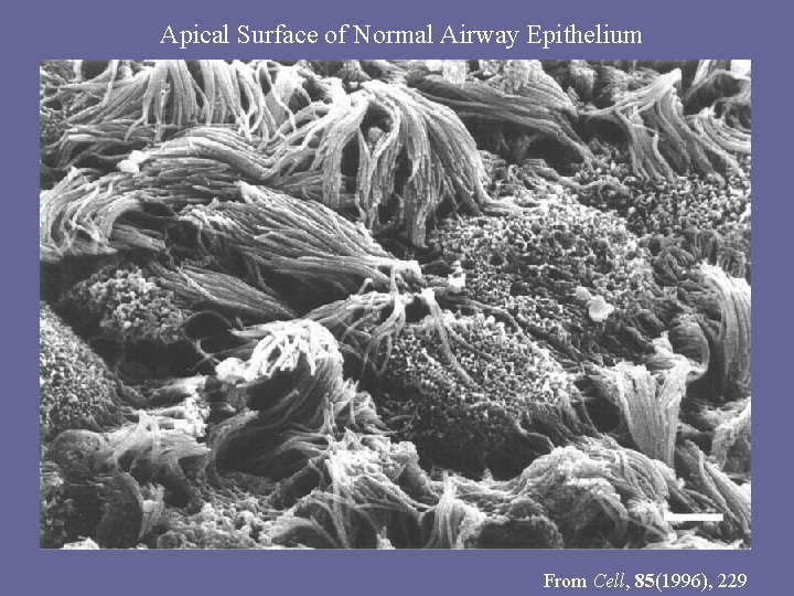 Apical Surface of Normal Airway Epithelium From Cell, 85(1996), 229 
