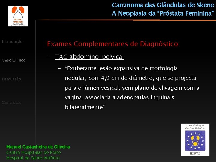Carcinoma das Glândulas de Skene A Neoplasia da “Próstata Feminina” Introdução Caso Clínico Exames