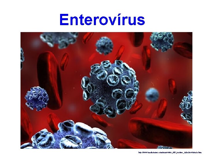 Enterovírus http: //www. medicinenet. com/enterovirus_d 68_pictures_slideshow/article. htm 