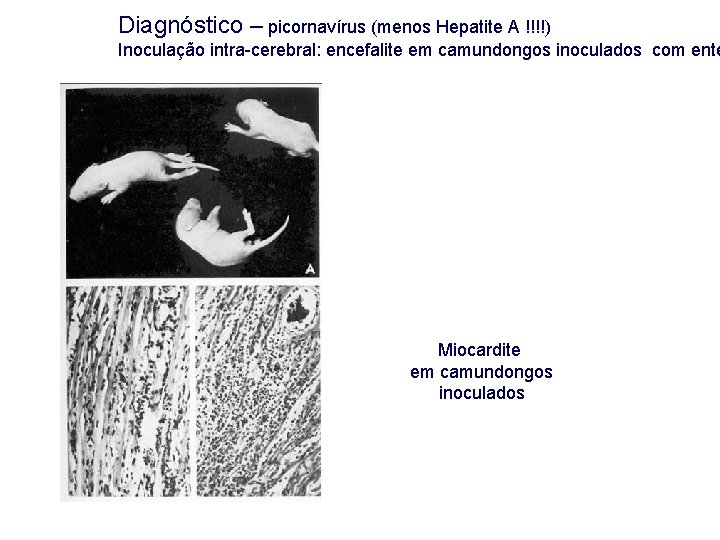 Diagnóstico – picornavírus (menos Hepatite A !!!!) Inoculação intra-cerebral: encefalite em camundongos inoculados com