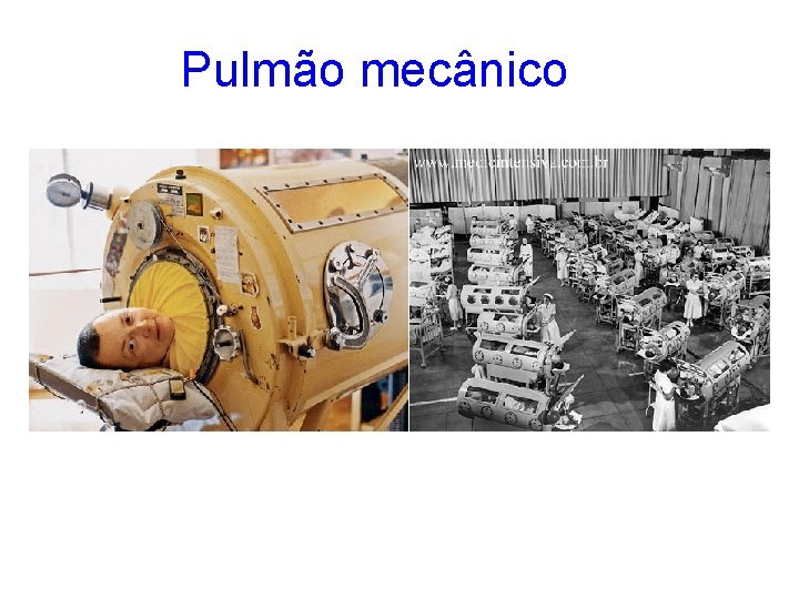 Pulmão mecânico 
