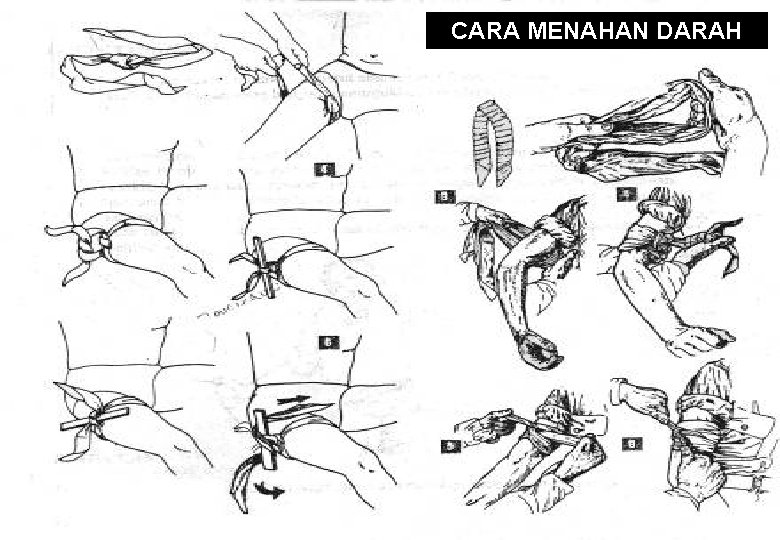 CARA MENAHAN DARAH 