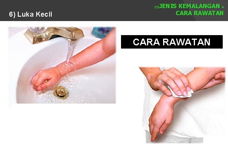 JENIS KEMALANGAN & CARA RAWATAN (5) 6) Luka Kecil CARA RAWATAN 