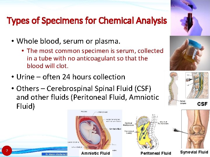Types of Specimens for Chemical Analysis • Whole blood, serum or plasma. • The