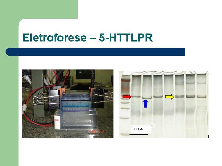 Eletroforese – 5 -HTTLPR 