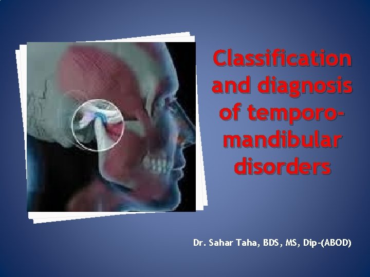 Classification and diagnosis of temporomandibular disorders Dr. Sahar Taha, BDS, MS, Dip-(ABOD) 