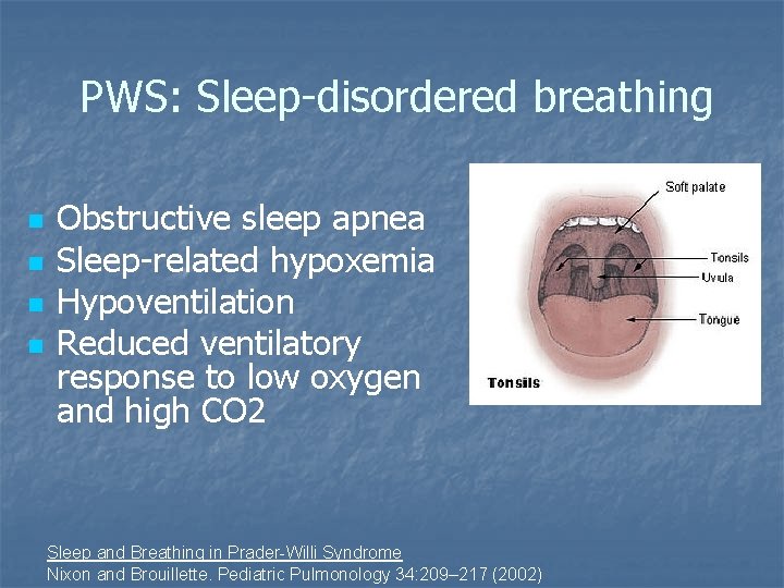 PWS: Sleep-disordered breathing n n Obstructive sleep apnea Sleep-related hypoxemia Hypoventilation Reduced ventilatory response