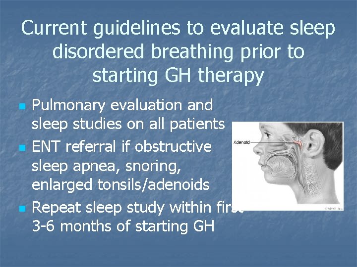 Current guidelines to evaluate sleep disordered breathing prior to starting GH therapy n n