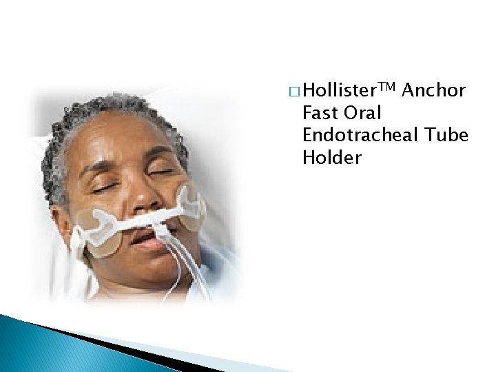 � Hollister. TM Anchor Fast Oral Endotracheal Tube Holder 
