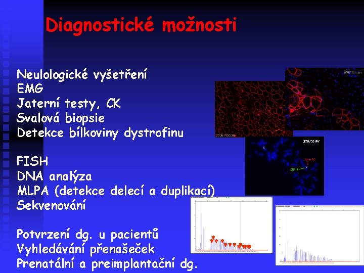 Diagnostické možnosti Neulologické vyšetření EMG Jaterní testy, CK Svalová biopsie Detekce bílkoviny dystrofinu FISH