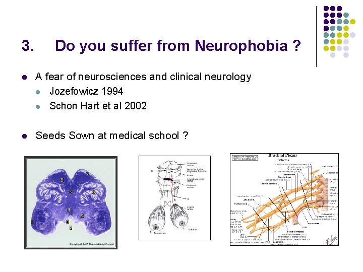 3. Do you suffer from Neurophobia ? l A fear of neurosciences and clinical