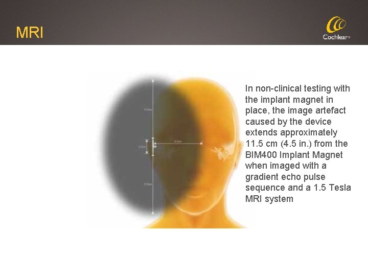 MRI In non-clinical testing with the implant magnet in place, the image artefact caused