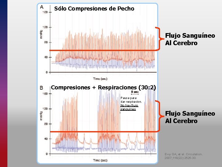 Sólo Compresiones de Pecho Flujo Sanguíneo Al Cerebro Compresiones + Respiraciones (30: 2) Pausa