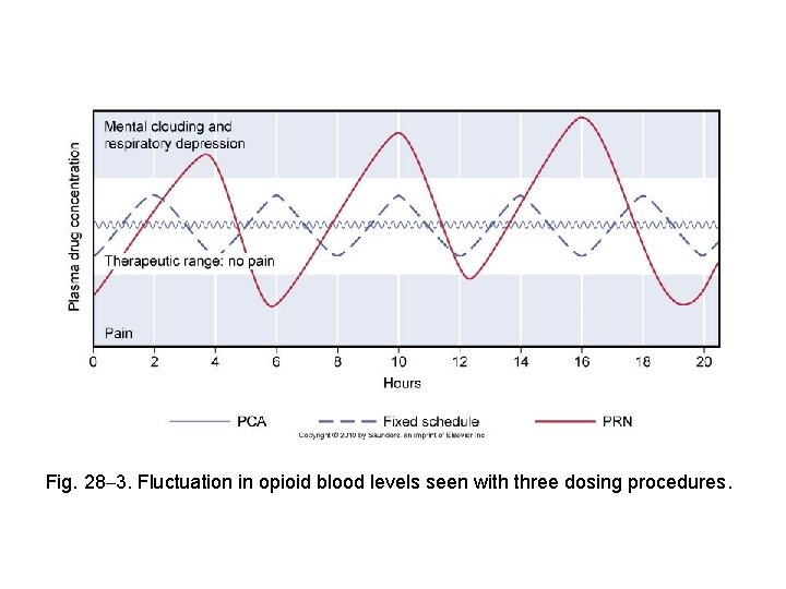 Fig. 28– 3. Fluctuation in opioid blood levels seen with three dosing procedures. 