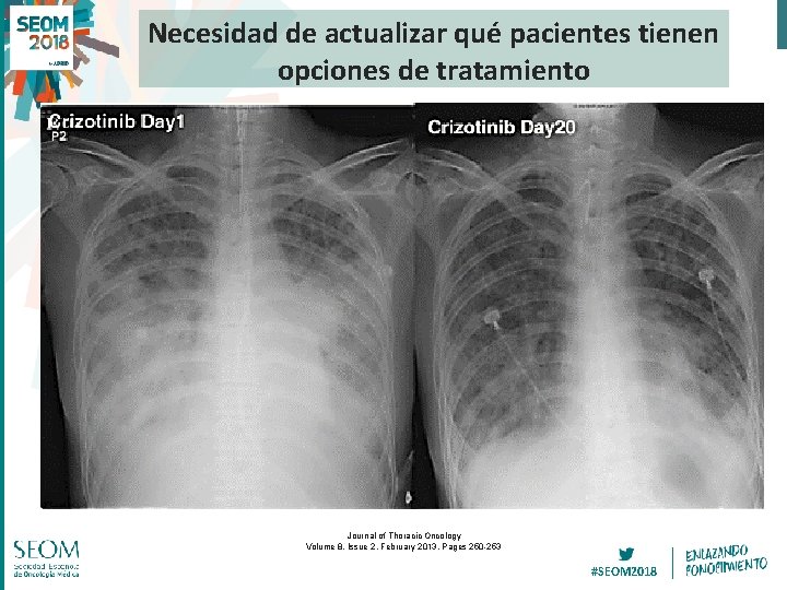 Necesidad de actualizar qué pacientes tienen opciones de tratamiento Journal of Thoracic Oncology Volume