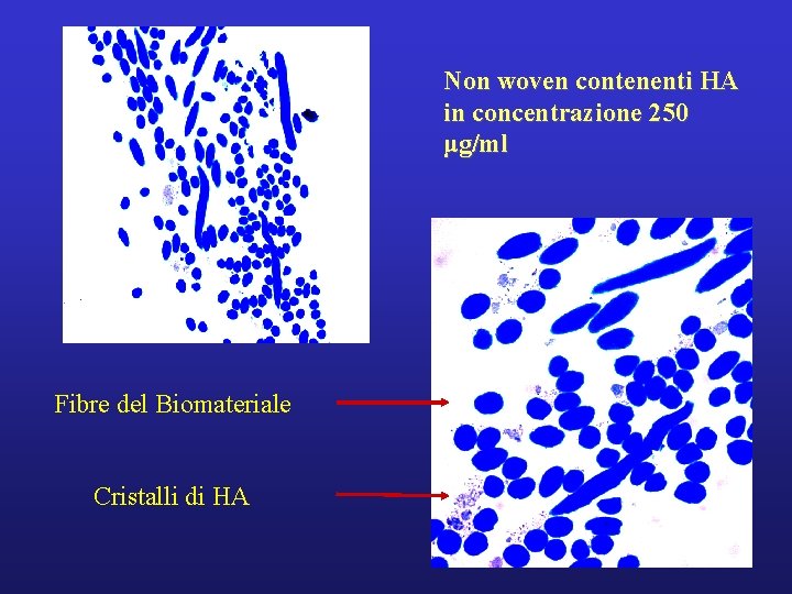 Non woven contenenti HA in concentrazione 250 μg/ml Fibre del Biomateriale Cristalli di HA