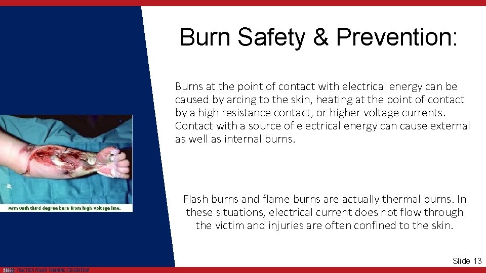 Burn Safety & Prevention: Burns at the point of contact with electrical energy can