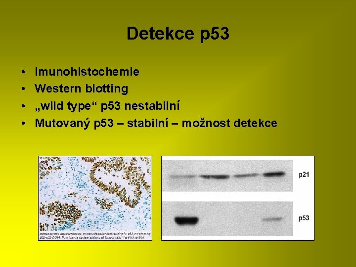 Detekce p 53 • • Imunohistochemie Western blotting „wild type“ p 53 nestabilní Mutovaný